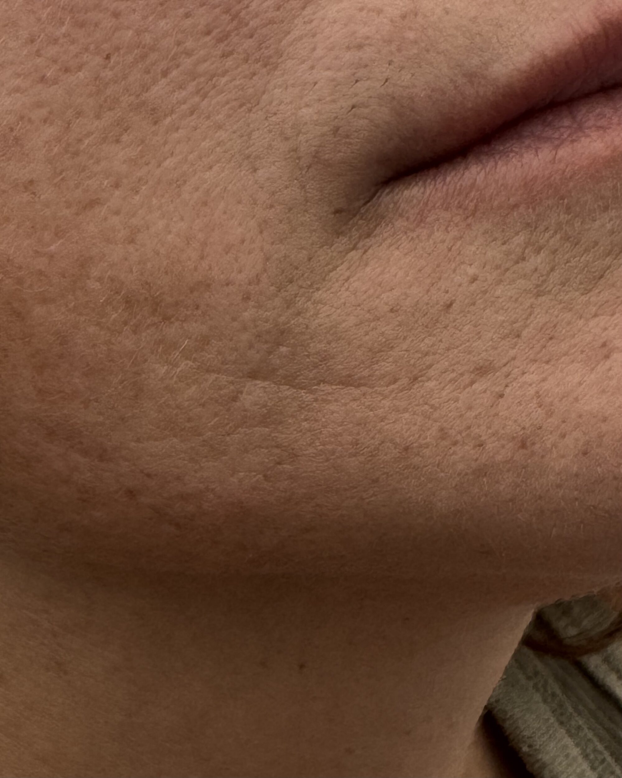 After Image: Filler - right-front-oblique